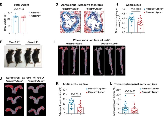 內(nèi)皮 PHACTR1 通過抑制小鼠血流紊亂下的 PPARγ 活性來促進內(nèi)皮細胞活化和動脈粥樣硬化