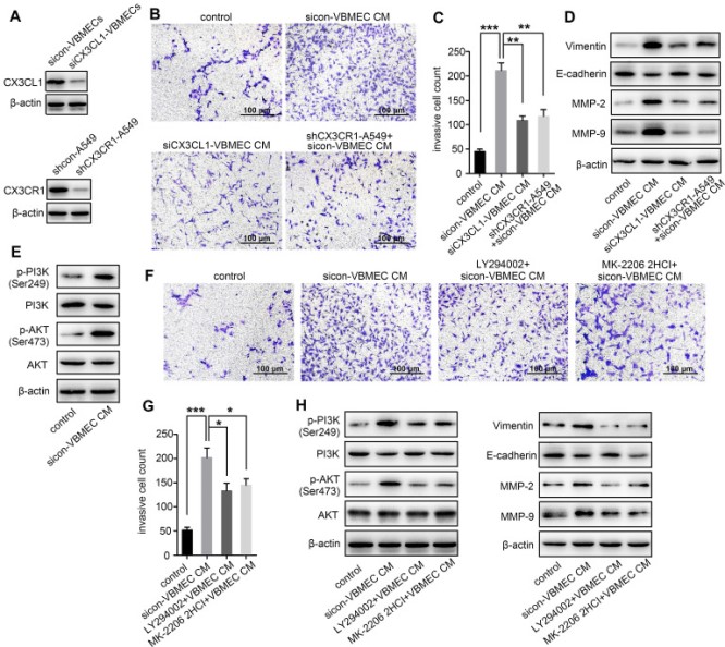 預(yù)防NSCLC脊柱轉(zhuǎn)移的潛在新靶點(diǎn)