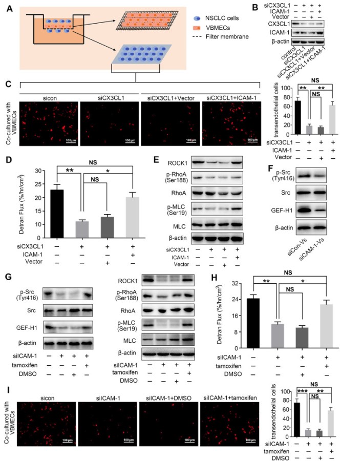 預(yù)防NSCLC脊柱轉(zhuǎn)移的潛在新靶點(diǎn)