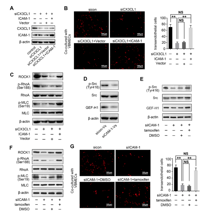 預(yù)防NSCLC脊柱轉(zhuǎn)移的潛在新靶點