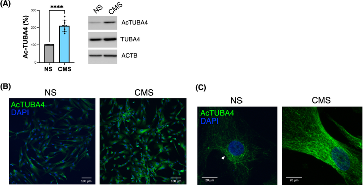 微管蛋白乙?；鰪?qiáng)機(jī)械應(yīng)力下小梁網(wǎng)細(xì)胞的微管穩(wěn)定性