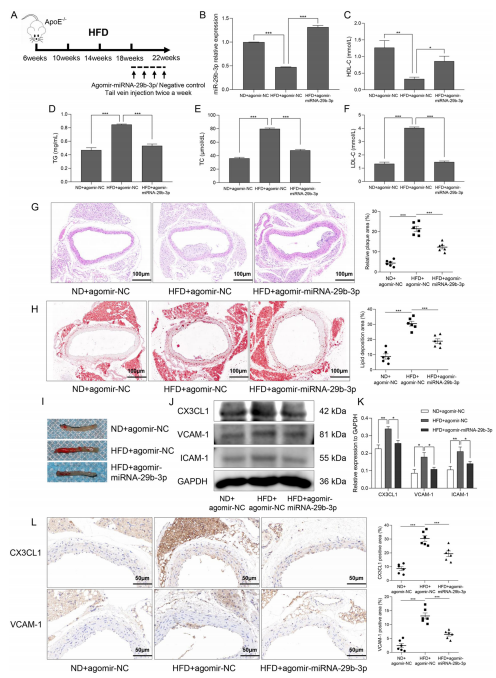層流剪切應(yīng)力通過調(diào)控 miR - 29b - 3p/CX3CL1 軸減輕單核細(xì)胞黏附及動(dòng)脈粥樣硬化發(fā)展