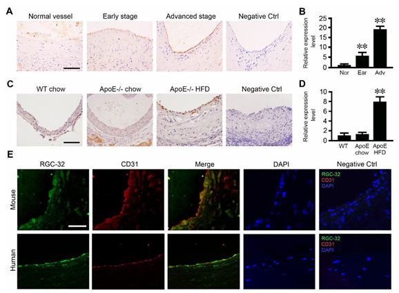 RGC-32 缺失可保護(hù)內(nèi)皮細(xì)胞免受炎癥損傷并減輕動(dòng)脈粥樣硬化